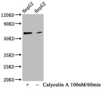 Western Blot; Positive WB detected in HepG2 whole cell lysate(treated with Calyculin A or not); All lanes Phospho-YAP1 antibody at 0.83ug/ml; Secondary; Goat polyclonal to rabbit IgG at 1/50000 dilution; Predicted band size: 65 KDa; Observed band size: 65 KDa