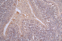 IHC image of RAC07667 diluted at 1:50 and staining in paraffin-embedded human lung tissue performed on a Leica BondTM system. After dewaxing and hydration, antigen retrieval was mediated by high pressure in a citrate buffer (pH 6.0). Section was blocked with 10% normal goat serum 30min at RT. Then primary antibody (1% BSA) was incubated at 4°C overnight. The primary is detected by a Goat anti-rabbit polymer IgG labeled by HRP and visualized using 0.63% DAB.
