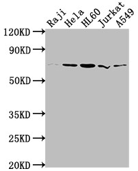 Western Blot; Positive WB detected in: Raji whole cell lysate, Hela whole cell lysate, HL60 whole cell lysate, Jurkat whole cell lysate, A549 whole cell lysate; All lanes: PRMT5 antibody at 1:2000; Secondary; Goat polyclonal to rabbit IgG at 1/50000 dilution; Predicted band size: 73, 72, 54, 68, 67 kDa; Observed band size: 73 kDa