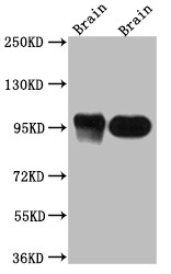Western Blot; Positive WB detected in: Rat Brain whole cell lysate, Mouse Brain whole cell lysate; All lanes: PSD95 antibody at 1:1000; Secondary; Goat polyclonal to rabbit IgG at 1/50000 dilution; Predicted band size: 81, 86, 81 kDa; Observed band size: 95 kDa