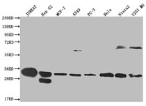 Western Blot; Positive WB detected in: Jurkat whole cell lysate, HepG2 whole cell lysate, MCF-7 whole cell lysate, A549 whole cell lysate, PC3 whole cell lysate, Hela whole cell lysate, Ntera-2 whole cell lysate, U251 whole cell lysate; All lanes: PSME1 antibody at 1:2000; Secondary; Goat polyclonal to rabbit IgG at 1/50000 dilution; Predicted band size: 29, 27 kDa; Observed band size: 28-30, 55-72 kDa
