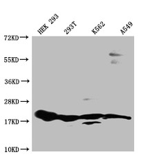 Western Blot; Positive WB detected in: HEK293 whole cell lysate, 293T whole cell lysate, K562 whole cell lysate, A549 whole cell lysate; All lanes: RPS19 antibody at 1:1000; Secondary; Goat polyclonal to rabbit IgG at 1/50000 dilution; Predicted band size: 17 kDa; Observed band size: 15-20 kDa