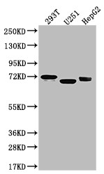 Western Blot; Positive WB detected in: U-87 whole cell lysate, 293T whole cell lysate, U-251 whole cell lysate, HepG2 whole cell lysate; All lanes: Serotonin transporter antibody at 1:1000; Secondary; Goat polyclonal to rabbit IgG at 1/50000 dilution; Predicted band size: 71, 75 kDa; Observed band size: 55 kDa