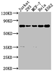 Western Blot; Positive WB detected in: Jurkat whole cell lysate, 293 whole cell lysate, MCF-7 whole cell lysate, Hela whole cell lysate, K562 whole cell lysate; All lanes: PTPN11 antibody at 1:2000; Secondary; Goat polyclonal to rabbit IgG at 1/50000 dilution; Predicted band size: 69, 53 kDa; Observed band size: 69 kDa