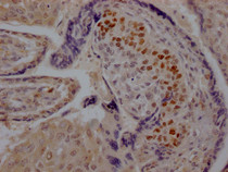 IHC image of RAC07739 diluted at 1:100 and staining in paraffin-embedded human placenta tissue performed on a Leica BondTM system. After dewaxing and hydration, antigen retrieval was mediated by high pressure in a citrate buffer (pH 6.0). Section was blocked with 10% normal goat serum 30min at RT. Then primary antibody (1% BSA) was incubated at 4? overnight. The primary is detected by a Goat anti-rabbit IgG polymer labeled by HRP and visualized using 0.05% DAB.