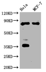 Western Blot; Positive WB detected in:Hela whole cell lysate, MCF-7 whole cell lysate; All lanes: STAT3 antibody at 1:2000; Secondary; Goat polyclonal to rabbit IgG at 1/50000 dilution; Predicted band size: 89, 88, 84 kDa; Observed band size: 89 kDa