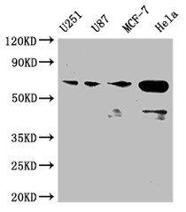 Western Blot; Positive WB detected in: U251 whole cell lysate, U87 whole cell lysate, MCF-7 whole cell lysate, Hela whole cell lysate; All lanes: STK3 antibody at 1:2000; Secondary; Goat polyclonal to rabbit IgG at 1/50000 dilution; Predicted band size: 57, 60 kDa; Observed band size: 50-70 kDa