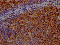 IHC image of RAC07771 diluted at 1:100 and staining in paraffin-embedded human tonsil tissue performed on a Leica BondTM system. After dewaxing and hydration, antigen retrieval was mediated by high pressure in a citrate buffer (pH 6.0). Section was blocked with 10% normal goat serum 30min at RT. Then primary antibody (1% BSA) was incubated at 4? overnight. The primary is detected by a Goat anti-rabbit IgG polymer labeled by HRP and visualized using 0.05% DAB.