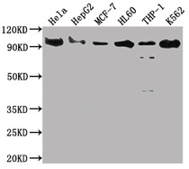 Western Blot; Positive WB detected in: Hela whole cell lysate, HepG2 whole cell lysate, MCF-7 whole cell lysate, HL60 whole cell lysate, THP-1 whole cell lysate, K562 whole cell lysate; All lanes: SUZ12 antibody at 1:2000; Secondary; Goat polyclonal to rabbit IgG at 1/50000 dilution; Predicted band size: 84 kDa; Observed band size: 90 kDa