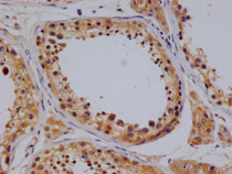 IHC image of RAC07775 diluted at 1:100 and staining in paraffin-embedded human testis tissue performed on a Leica BondTM system. After dewaxing and hydration, antigen retrieval was mediated by high pressure in a citrate buffer (pH 6.0). Section was blocked with 10% normal goat serum 30min at RT. Then primary antibody (1% BSA) was incubated at 4°C overnight. The primary is detected by a Goat anti-rabbit polymer IgG labeled by HRP and visualized using 0.05% DAB.