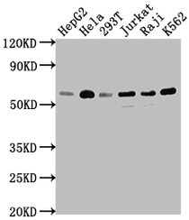 Western Blot; Positive WB detected in: HepG2 whole cell lysate, Hela whole cell lysate, 293T whole cell lysate, Jurkat whole cell lysate, Raji whole cell lysate, K562 whole cell lysate; All lanes: TRAF2 antibody at 1:1500; Secondary; Goat polyclonal to rabbit IgG at 1/50000 dilution; Predicted band size: 56, 62, 55, 54 kDa; Observed band size: 56 kDa
