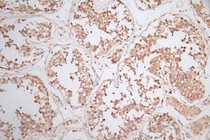 IHC image of RAC07814 diluted at 1:50 and staining in paraffin-embedded human testis tissue performed on a Leica BondTM system. After dewaxing and hydration, antigen retrieval was mediated by high pressure in a citrate buffer (pH 6.0). Section was blocked with 10% normal goat serum 30min at RT. Then primary antibody (1% BSA) was incubated at 4°C overnight. The primary is detected by a Goat anti-rabbit polymer IgG labeled by HRP and visualized using 0.79% DAB.