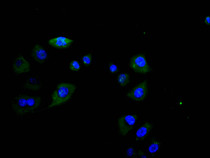 Immunofluorescence staining of Hela cell with RAC07868 at 1:30, counter-stained with DAPI. The cells were fixed in 4% formaldehyde and blocked in 10% normal Goat Serum. The cells were then incubated with the antibody overnight at 4C. The secondary antibody was Alexa Fluor 488-congugated AffiniPure Goat Anti-Rabbit IgG(H+L).