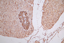 IHC image of RAC07869 diluted at 1:100 and staining in paraffin-embedded human pancreatic tissue performed on a Leica BondTM system. After dewaxing and hydration, antigen retrieval was mediated by high pressure in a citrate buffer (pH 6.0). Section was blocked with 10% normal goat serum 30min at RT. Then primary antibody (1% BSA) was incubated at 4°C overnight. The primary is detected by a Goat anti-Rabbit IgG labeled by HRP and visualized using 0.05% DAB.