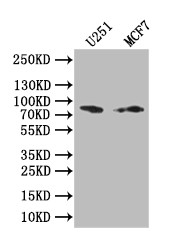 Western Blot; Positive WB detected in: U251 whole cell lysate, MCF7 whole cell lysate; All lanes: GSN antibody at 1:1000; Secondary; Goat polyclonal to rabbit IgG at 1/50000 dilution; Predicted band size: 85 kDa; Observed band size: 85 kDa