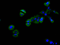Immunofluorescence staining of SH-SY5Y cell with RAC07903 at 1:30, counter-stained with DAPI. The cells were fixed in 4% formaldehyde and blocked in 10% normal Goat Serum. The cells were then incubated with the antibody overnight at 4C. The secondary antibody was FITC-conjugated AffiniPure Goat Anti-Mouse IgG(H+L).