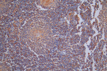 IHC image of RAC07949 diluted at 1:40 and staining in paraffin-embedded human tonsil tissue performed on a Leica BondTM system. After dewaxing and hydration, antigen retrieval was mediated by high pressure in a citrate buffer (pH 6.0). Section was blocked with 10% normal goat serum 30min at RT. Then primary antibody (1% BSA) was incubated at 4°C overnight. The primary is detected by a Goat anti-Rabbit IgG labeled by HRP and visualized using 0.05% DAB.