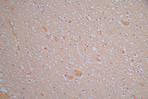 IHC image of RAC07979 diluted at 1:150 and staining in paraffin-embedded human brain tissue performed on a Leica BondTM system. After dewaxing and hydration, antigen retrieval was mediated by high pressure in a citrate buffer (pH 6.0). Section was blocked with 10% normal goat serum 30min at RT. Then primary antibody (1% BSA) was incubated at 4°C overnight. The primary is detected by a Goat anti-Rabbit IgG labeled by HRP and visualized using 0.05% DAB.