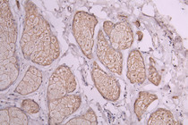 IHC image of RAC07982 diluted at 1:300 and staining in paraffin-embedded human skin tissue performed on a Leica BondTM system. After dewaxing and hydration, antigen retrieval was mediated by high pressure in a citrate buffer (pH 6.0). Section was blocked with 10% normal goat serum 30min at RT. Then primary antibody (1% BSA) was incubated at 4°C overnight. The primary is detected by a Goat anti-Human IgG labeled by HRP and visualized using 0.05% DAB.