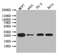 Western Blot, Positive WB detected in: PC-3 whole cell lysate, MCF7 whole cell lysate, Hela whole cell lysate, A431 whole cell lysate, All lanes: LGALS3 antibody at 1:1000, Secondary, Goat polyclonal to human IgG at 1/50000 dilution, Predicted band size: 26 kDa, Observed band size: 26 kDa