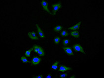 Immunofluorescence staining of Hela cell with RAC07984 at 1:150, counter-stained with DAPI. The cells were fixed in 4% formaldehyde and blocked in 10% normal Goat Serum. The cells were then incubated with the antibody overnight at 4C. The secondary antibody was FITC-conjugated AffiniPure Goat Anti-Human IgG(H+L).