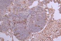 IHC image of RAC07991 diluted at 1:100 and staining in paraffin-embedded human lymph node tissue performed on a Leica BondTM system. After dewaxing and hydration, antigen retrieval was mediated by high pressure in a citrate buffer (pH 6.0). Section was blocked with 10% normal goat serum 30min at RT. Then primary antibody (1% BSA) was incubated at 4°C overnight. The primary is detected by a Goat anti-Human IgG labeled by HRP and visualized using 0.05% DAB.