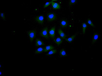 Immunofluorescence staining of MCF7 cell with RAC07992 at 1:100, counter-stained with DAPI. The cells were fixed in 4% formaldehyde and blocked in 10% normal Goat Serum. The cells were then incubated with the antibody overnight at 4C. The secondary antibody was FITC-conjugated AffiniPure Goat Anti-Human IgG(H+L).