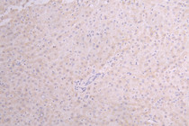 IHC image of RAC07993 diluted at 1:100 and staining in paraffin-embedded human Liver tissue performed on a Leica BondTM system. After dewaxing and hydration, antigen retrieval was mediated by high pressure in a citrate buffer (pH 6.0). Section was blocked with 10% normal goat serum 30min at RT. Then primary antibody (1% BSA) was incubated at 4°C overnight. The primary is detected by a Goat anti-Human IgG labeled by HRP and visualized using 0.05% DAB.