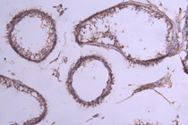 IHC image of RAC07996 diluted at 1:300 and staining in paraffin-embedded human testis tissue performed on a Leica BondTM system. After dewaxing and hydration, antigen retrieval was mediated by high pressure in a citrate buffer (pH 6.0). Section was blocked with 10% normal goat serum 30min at RT. Then primary antibody (1% BSA) was incubated at 4°C overnight. The primary is detected by a Goat anti-Human IgG labeled by HRP and visualized using 0.05% DAB.