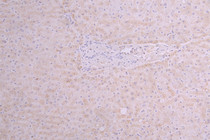 IHC image of RAC08004 diluted at 1：100 and staining in paraffin-embedded human liver tissue performed on a Leica BondTM system. After dewaxing and hydration, antigen retrieval was mediated by high pressure in a citrate buffer (pH 6.0). Section was blocked with 10% normal goat serum 30min at RT. Then primary antibody (1% BSA) was incubated at 4°C overnight. The primary is detected by a Goat anti-human polymer IgG labeled by HRP and visualized using 0.05% DAB.
