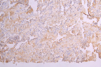 IHC image of RAC08009 diluted at 1：100 and staining in paraffin-embedded human lung tissue performed on a Leica BondTM system. After dewaxing and hydration, antigen retrieval was mediated by high pressure in a citrate buffer (pH 6.0). Section was blocked with 10% normal goat serum 30min at RT. Then primary antibody (1% BSA) was incubated at 4°C overnight. The primary is detected by a Goat anti-human polymer IgG labeled by HRP and visualized using 0.05% DAB.