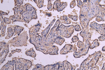 IHC image of RAC08010 diluted at 1:200 and staining in paraffin-embedded human placenta tissue performed on a Leica BondTM system. After dewaxing and hydration, antigen retrieval was mediated by high pressure in a citrate buffer (pH 6.0). Section was blocked with 10% normal goat serum 30min at RT. Then primary antibody (1% BSA) was incubated at 4°C overnight. The primary is detected by a Goat anti-human polymer IgG labeled by HRP and visualized using 0.05% DAB.