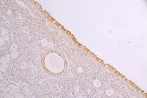 IHC image of RAC08014 diluted at 1：100 and staining in paraffin-embedded human ovarian tissue performed on a Leica BondTM system. After dewaxing and hydration, antigen retrieval was mediated by high pressure in a citrate buffer (pH 6.0). Section was blocked with 10% normal goat serum 30min at RT. Then primary antibody (1% BSA) was incubated at 4°C overnight. The primary is detected by a Goat anti-human polymer IgG labeled by HRP and visualized using 0.05% DAB.