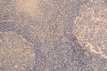 IHC image of RAC08015 diluted at 1:200 and staining in paraffin-embedded human tonsil tissue performed on a Leica BondTM system. After dewaxing and hydration, antigen retrieval was mediated by high pressure in a citrate buffer (pH 6.0). Section was blocked with 10% normal goat serum 30min at RT. Then primary antibody (1% BSA) was incubated at 4°C overnight. The primary is detected by a Goat anti-human polymer IgG labeled by HRP and visualized using 0.05% DAB.