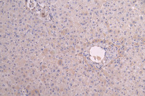 IHC image of RAC08018 diluted at 1:200 and staining in paraffin-embedded human liver tissue performed on a Leica BondTM system. After dewaxing and hydration, antigen retrieval was mediated by high pressure in a citrate buffer (pH 6.0). Section was blocked with 10% normal goat serum 30min at RT. Then primary antibody (1% BSA) was incubated at 4°C overnight. The primary is detected by a Goat anti-human polymer IgG labeled by HRP and visualized using 0.05% DAB.