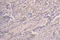 IHC image of RAC08019 diluted at 1:200 and staining in paraffin-embedded human lung tissue performed on a Leica BondTM system. After dewaxing and hydration, antigen retrieval was mediated by high pressure in a citrate buffer (pH 6.0). Section was blocked with 10% normal goat serum 30min at RT. Then primary antibody (1% BSA) was incubated at 4°C overnight. The primary is detected by a Goat anti-human polymer IgG labeled by HRP and visualized using 0.05% DAB.