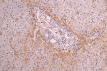 IHC image of RAC08022 diluted at 1：100 and staining in paraffin-embedded human liver tissue performed on a Leica BondTM system. After dewaxing and hydration, antigen retrieval was mediated by high pressure in a citrate buffer (pH 6.0). Section was blocked with 10% normal goat serum 30min at RT. Then primary antibody (1% BSA) was incubated at 4°C overnight. The primary is detected by a Goat anti-human polymer IgG labeled by HRP and visualized using 0.05% DAB.
