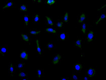 Immunofluorescence staining of MCF cell with RAC08023 at 1:100, counter-stained with DAPI. The cells were fixed in 4% formaldehyde and blocked in 10% normal Goat Serum. The cells were then incubated with the antibody overnight at 4C. The secondary antibody was FITC-conjugated AffiniPure Goat Anti-Human IgG(H+L).