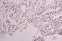 IHC image of RAC08027 diluted at 1：100 and staining in paraffin-embedded human testis tissue performed on a Leica BondTM system. After dewaxing and hydration, antigen retrieval was mediated by high pressure in a citrate buffer (pH 6.0). Section was blocked with 10% normal goat serum 30min at RT. Then primary antibody (1% BSA) was incubated at 4°C overnight. The primary is detected by a Goat anti-human polymer IgG labeled by HRP and visualized using 0.05% DAB.