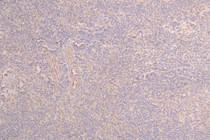 IHC image of RAC08028 diluted at 1：100 and staining in paraffin-embedded human testis tissue performed on a Leica BondTM system. After dewaxing and hydration, antigen retrieval was mediated by high pressure in a citrate buffer (pH 6.0). Section was blocked with 10% normal goat serum 30min at RT. Then primary antibody (1% BSA) was incubated at 4°C overnight. The primary is detected by a Goat anti-human polymer IgG labeled by HRP and visualized using 0.05% DAB.