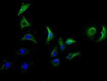 Immunofluorescence staining of A549 cell at 1:50, counter-stained with DAPI. The cells were fixed in 4% formaldehyde and blocked in 10% normal Goat Serum. The cells were then incubated with the antibody overnight at 4C. The secondary antibody was FITC-conjugated AffiniPure Goat Anti-Mouse IgG(H+L).