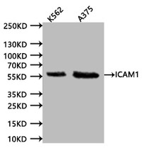 Western Blot. Positive WB detected in:K562 whole cell lysate (20µg), A375 whole cell lysate (20µg). All lanes: ICAM1 antibody at 1:1000. Secondary. Goat polyclonal to human IgG at 1/40000 dilution. Predicted band size:57.83 kDa. Observed band size:58 kDa. Exposure time:120s