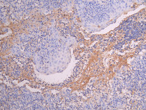 IHC image diluted at 1:150 and staining in paraffin-embedded human tonsil tissue performed on a Leica BondTM system. After dewaxing and hydration, antigen retrieval was mediated by high pressure in a citrate buffer (pH 6.0). Section was blocked with 10% normal goat serum 30min at RT. Then primary antibody (1% BSA) was incubated at 4°C overnight. The primary is detected by a Goat anti-human polymer IgG labeled by HRP and visualized using 0.05% DAB.