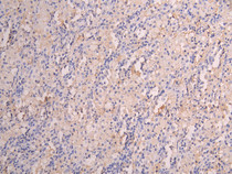 IHC image diluted at 1:150 and staining in paraffin-embedded human lung tissue performed on a Leica BondTM system. After dewaxing and hydration, antigen retrieval was mediated by high pressure in a citrate buffer (pH 6.0). Section was blocked with 10% normal goat serum 30min at RT. Then primary antibody (1% BSA) was incubated at 4°C overnight. The primary is detected by a Goat anti-human polymer IgG labeled by HRP and visualized using 0.05% DAB.