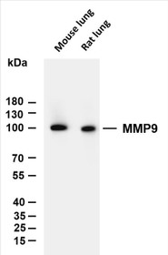 Various whole cell lysates were separated by 10% SDS-PAGE, and the membrane was blotted with anti-MMP9 (PT0044R) antibody. The HRP-conjugated Goat anti-Rabbit IgG(H + L) antibody was used to detect the antibody.