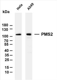 Various whole cell lysates were separated by 4-20% SDS-PAGE, and the membrane was blotted with anti-PMS2(PT0045R) antibody. The HRP-conjugated Goat anti-Rabbit IgG(H + L) antibody was used to detect the antibody.