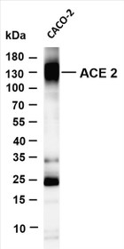 Various whole cell lysates were separated by 4-20% SDS-PAGE, and the membrane was blotted with anti-ACE2 (PT0084R) antibody. The HRP-conjugated Goat anti-Rabbit IgG(H + L) antibody was used to detect the antibody.