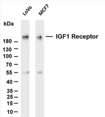 Various whole cell lysates were separated by 4-20% SDS-PAGE, and the membrane was blotted with anti-IGF1 Receptor (PT0136R) antibody. The HRP-conjugated Goat anti-Rabbit IgG(H + L) antibody was used to detect the antibody.