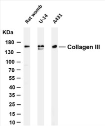 Various whole cell lysates were separated by 4-20% SDS-PAGE, and the membrane was blotted with anti-Collagen III (PT0180R) antibody. The HRP-conjugated Goat anti-Rabbit IgG(H + L) antibody was used to detect the antibody.