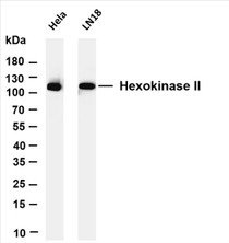 Various whole cell lysates were separated by 4-20% SDS-PAGE, and the membrane was blotted with anti-Hexokinase II (PT0189R) antibody. The HRP-conjugated Goat anti-Rabbit IgG(H + L) antibody was used to detect the antibody.